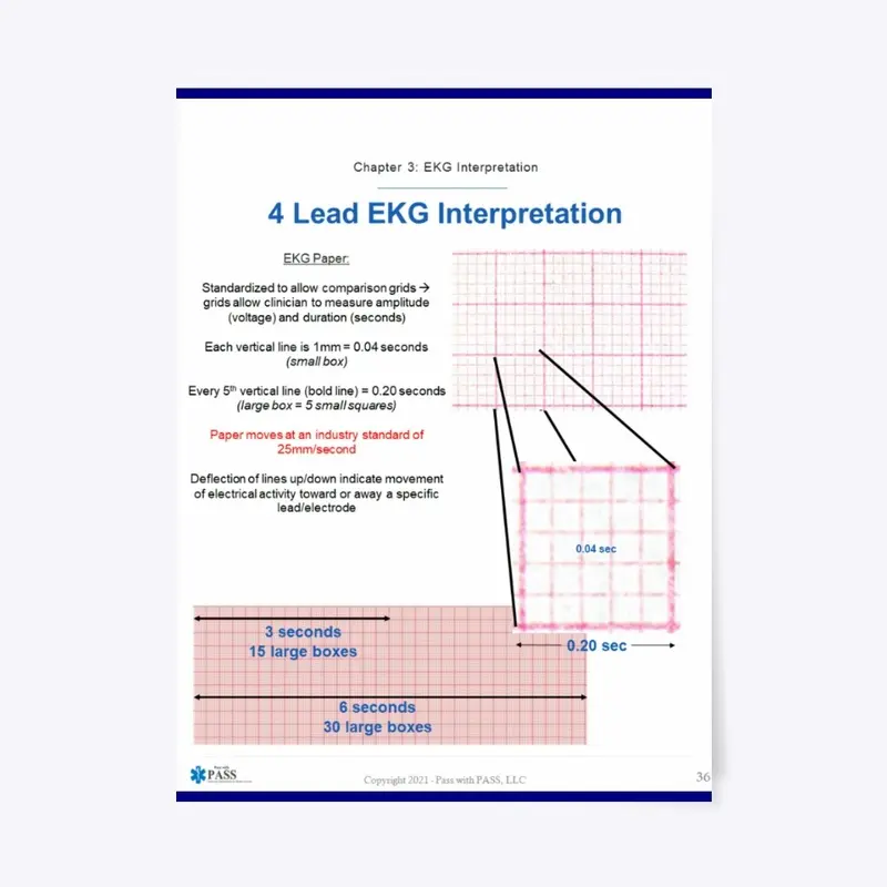 4 Lead EKG - 18" x 24" Poster